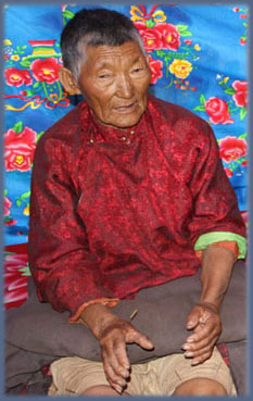 acupunture treatment in Tibet